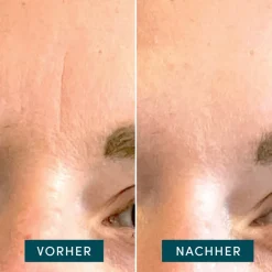 APRICOT Baumwoll-Gesichtspflaster mit Hyaluron 24 Stück