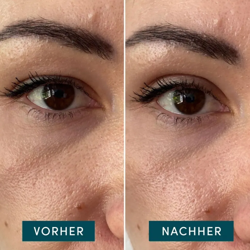 APRICOT Eyelid Lifting Tapes 96 Stück