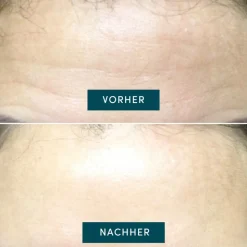 Apricot Wiederverwendbares Stirn Pad mit Aloe Vera