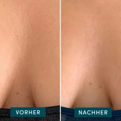 Apricot Wiederverwendbares Dekolleté Pad mit Ectoin