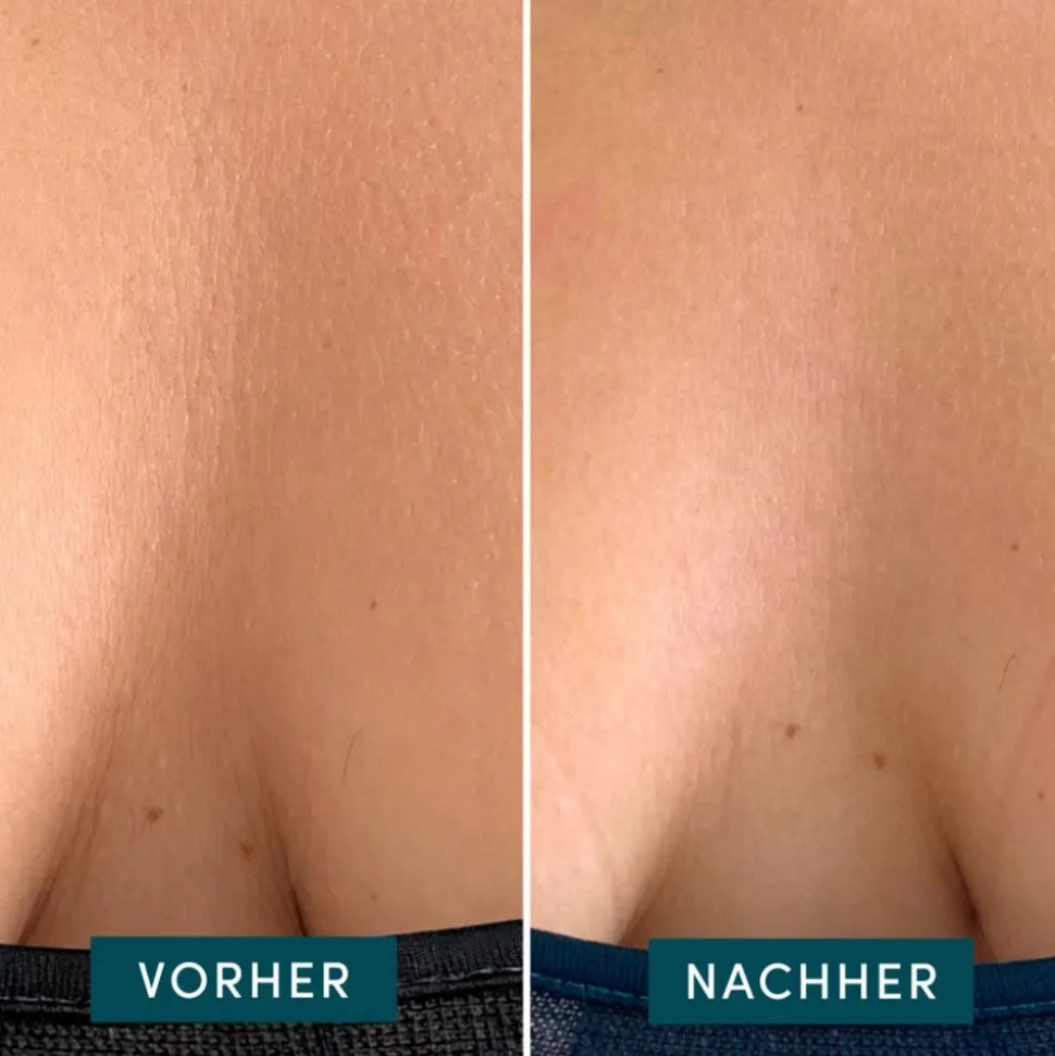 Apricot Wiederverwendbares Dekolleté Pad mit Ectoin