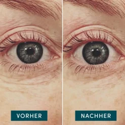 Apricot Wiederverwendbare Augen Pads mit Hyaluron