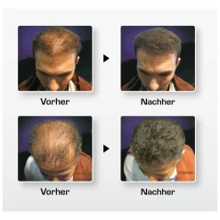 BioThik Haaraufbau-Faser S4 hellbraun 25 g