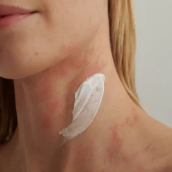 DADO SENS EXTRODERM Intensivcreme 50 ml