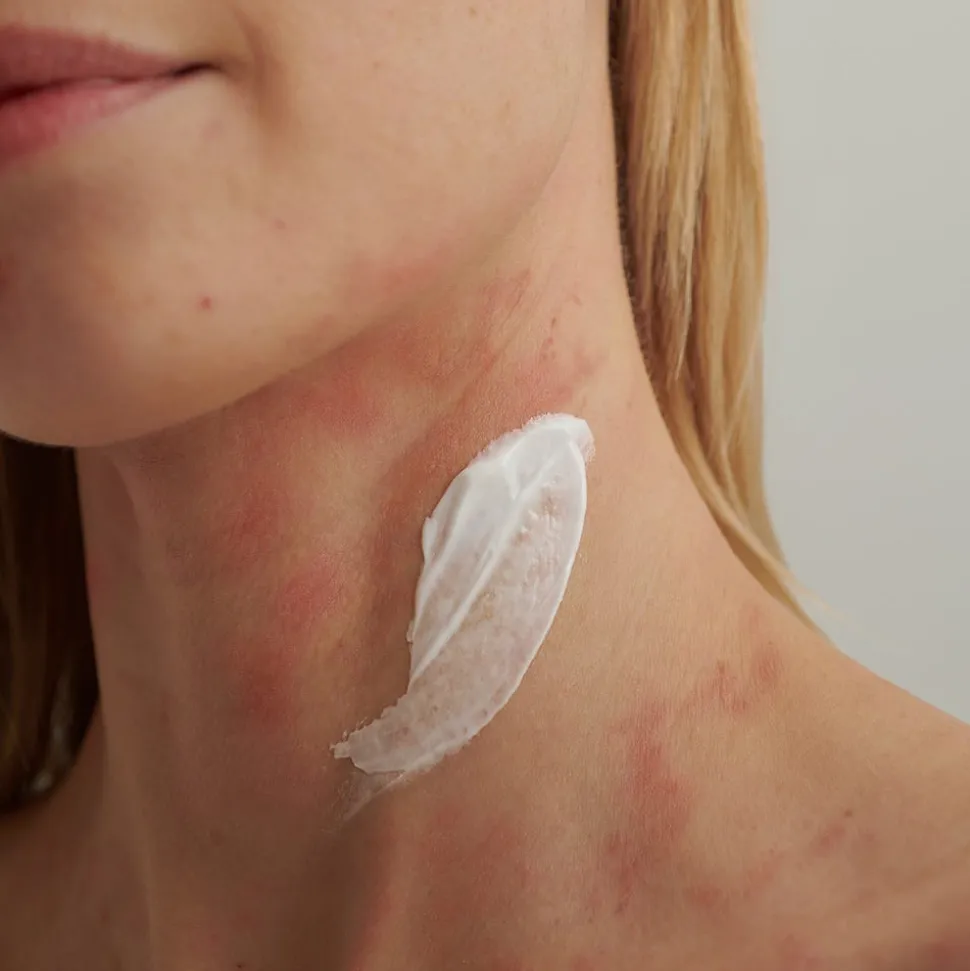 DADO SENS EXTRODERM Intensivcreme 50 ml