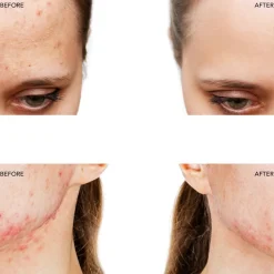 FOREO Sweden ESPADA 2 Fuchsia