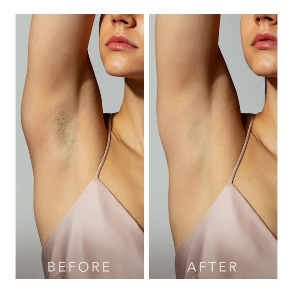 FOREO Sweden PRECH™ 2 Mint IPL Gerät