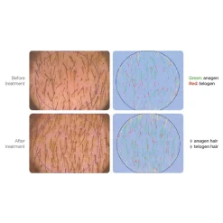 ICON 5.25 Leave-In Lotion 100 ml