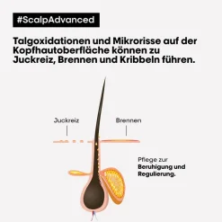 L'Oréal Professionnel Paris Série Expert Scalp Advanced Anti-Discomfort Intese Soother Treatment 200 ml