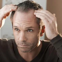 Natucain Hair Activator 100 ml