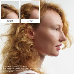 Nioxin Scalp + Hair Thickening System 1 Set