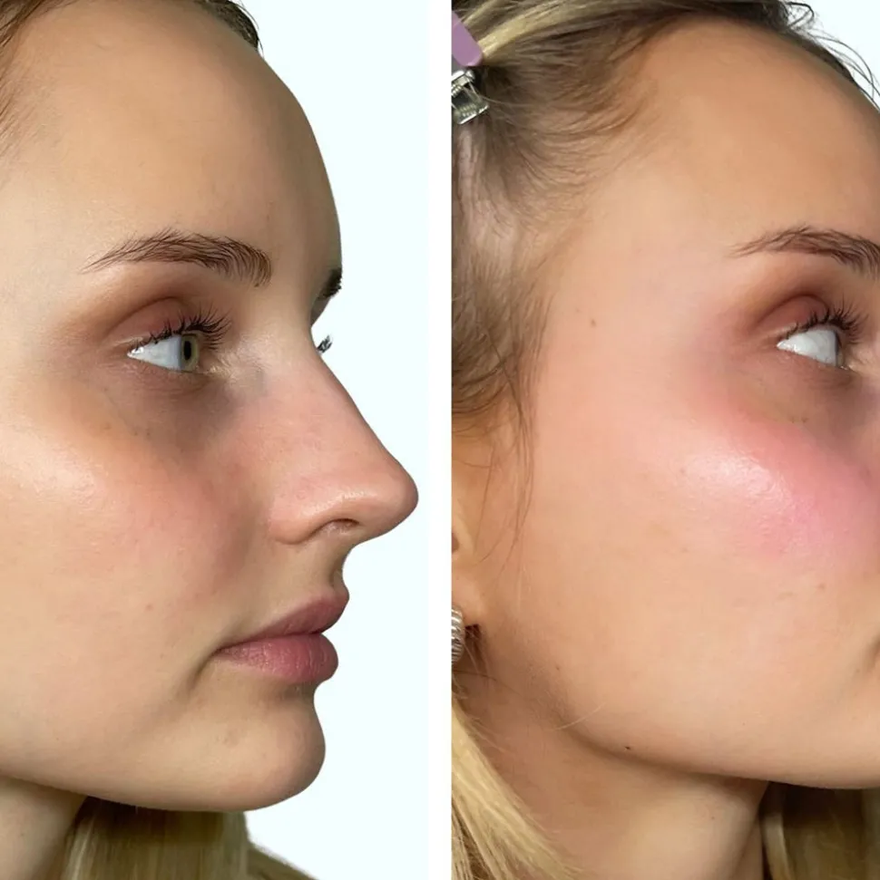 Venicebody PH-Activated Blush Stick Lip & Cheek 6,2 g